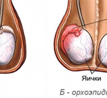 Воспалительные заболевания