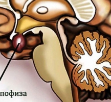 Болезни гипофиза и надпочечников